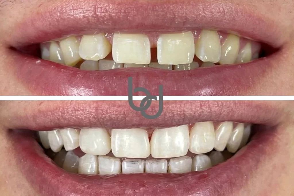 Case 1: Before after image